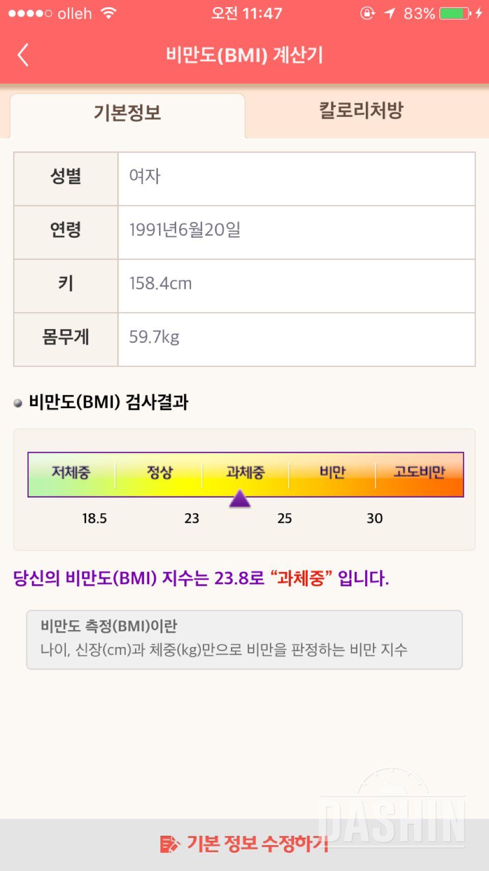 26년간 부종과 지방으로 덥혀진 제 발목을 찾고 싶습니다.도와주세요!