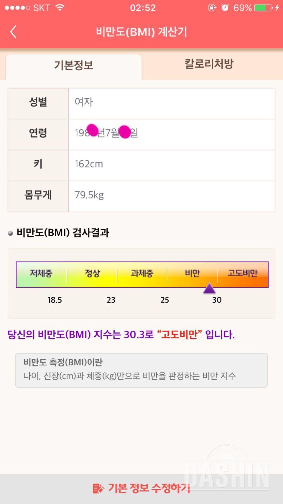 허벅지 그만 쓸리고 싶어요