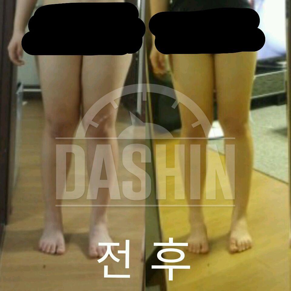 3주차/허리에 이어 하체까지 변화가 생긴 것 같아요!