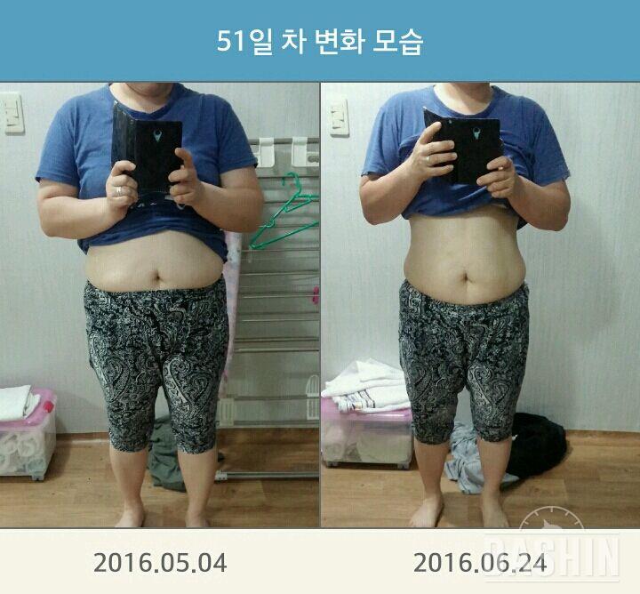 만보걷기 B&A