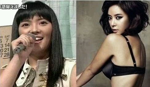 확정음 비포 애프터