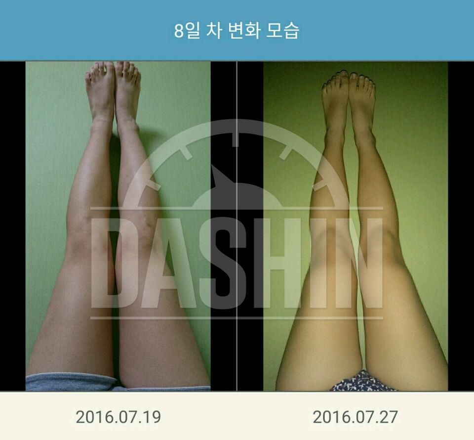 몸무게는 고대론데...