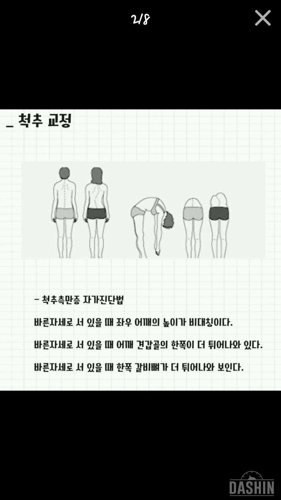 척추가이뻐야지 몸매도이쁜법!!😐