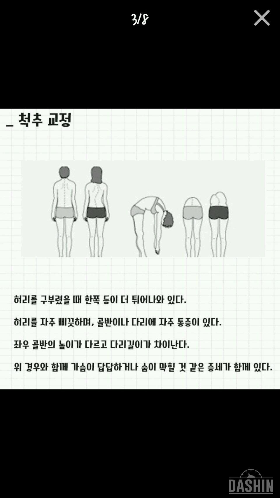 척추가이뻐야지 몸매도이쁜법!!😐