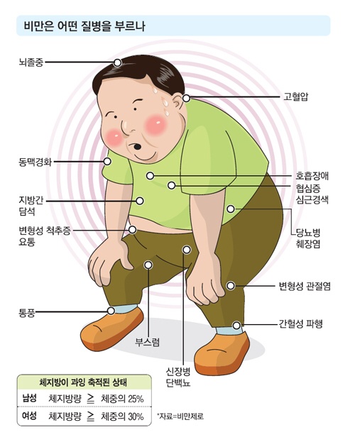 비만은 어떤 질병을 부르나?