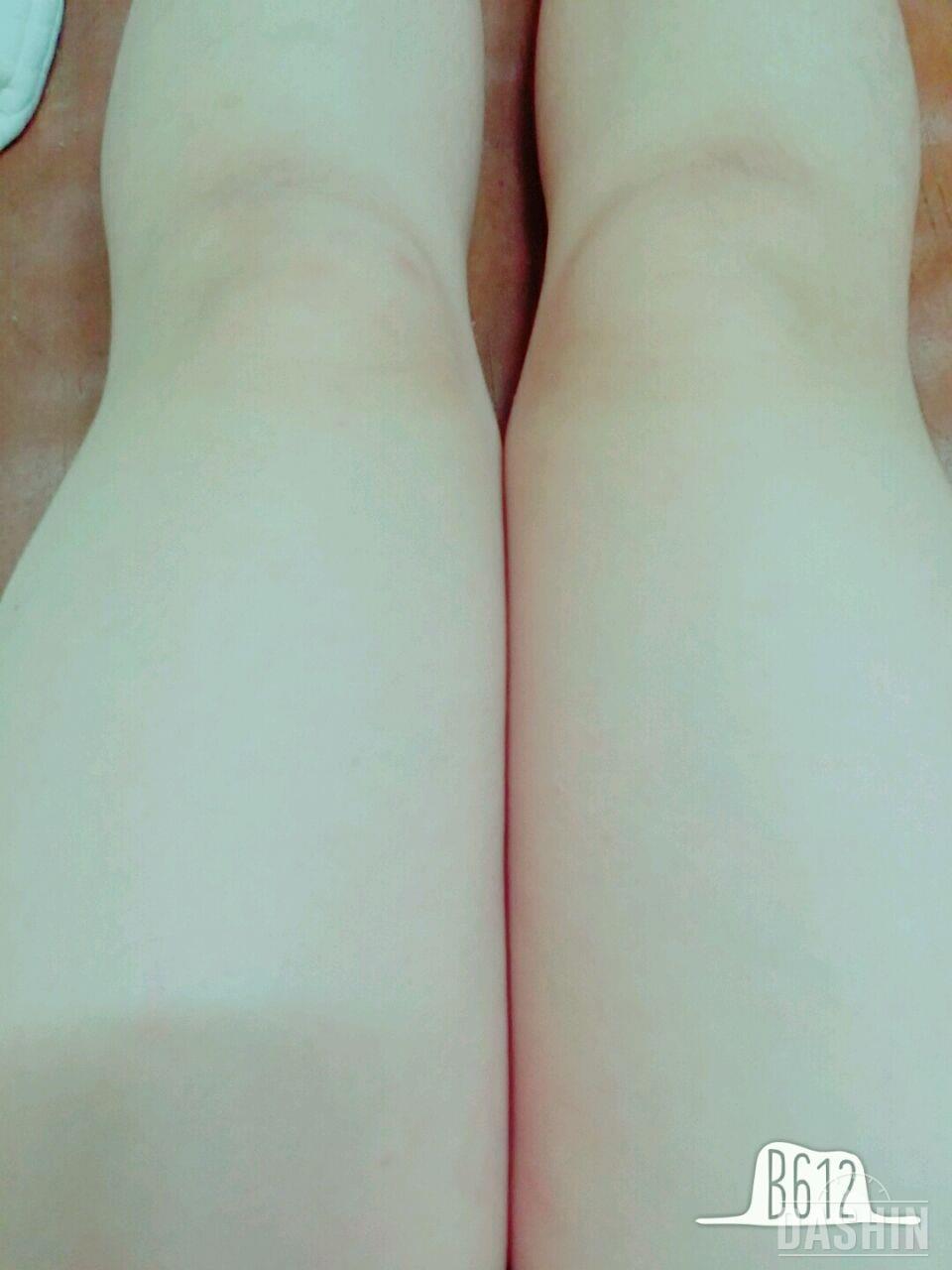 12일차 다리가너무굵은건가.....짜도짜도 안나오네ㅋㅋㄱ