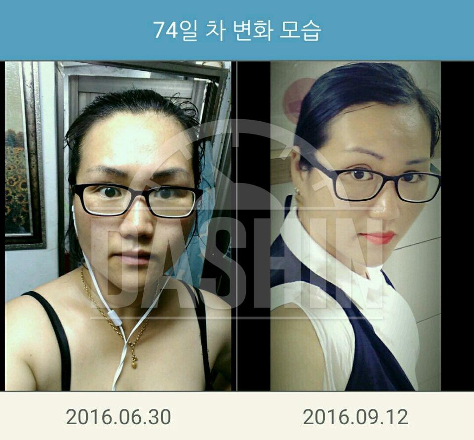 살이쪘다진짜진짜힘들게빼고...