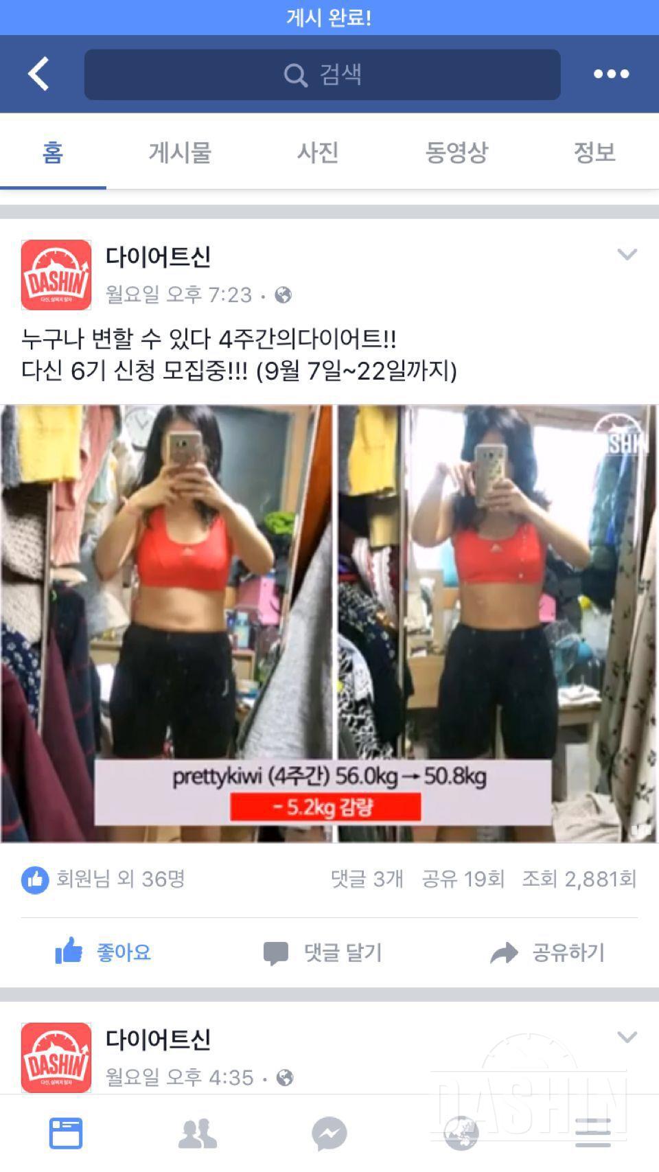 이것저것 안해본 것이 없는 ㅜㅜ 결혼을 앞두고 진짜 간절합니다.