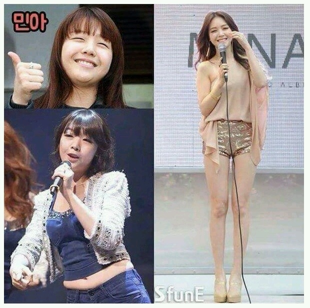 연예인 비포애프터