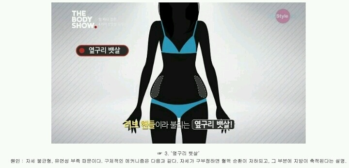 여자 뱃살 유형