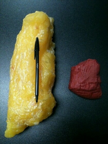 지방1kg vs 근육1kg