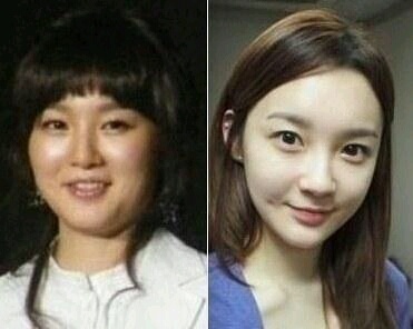 여자 연예인들 다이어트 비포 & 애프터 2