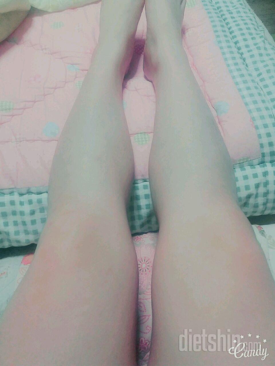 다리알ㅠㅠ