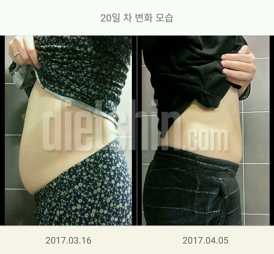 20일간 눈바디