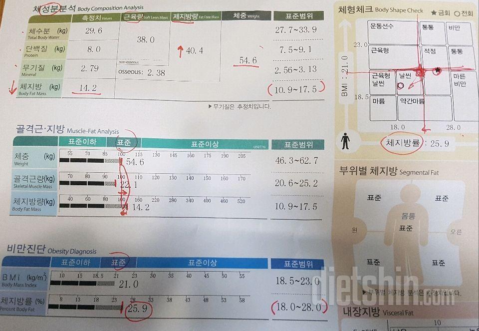 마이케어 핑거루트환 스타트♦첫번째♦