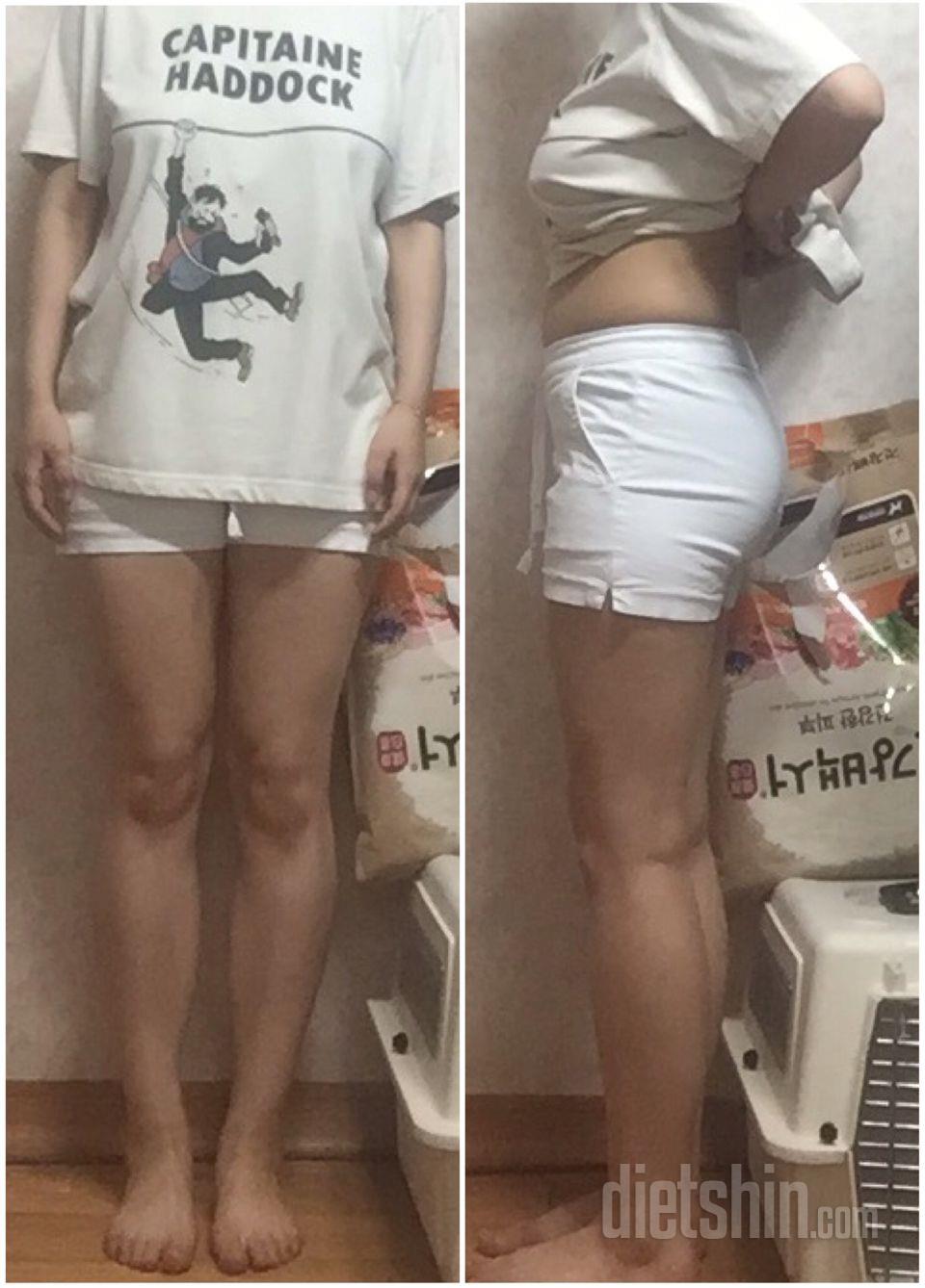 다리에 더 이상 피 안통하는 느낌이 들기싫어요