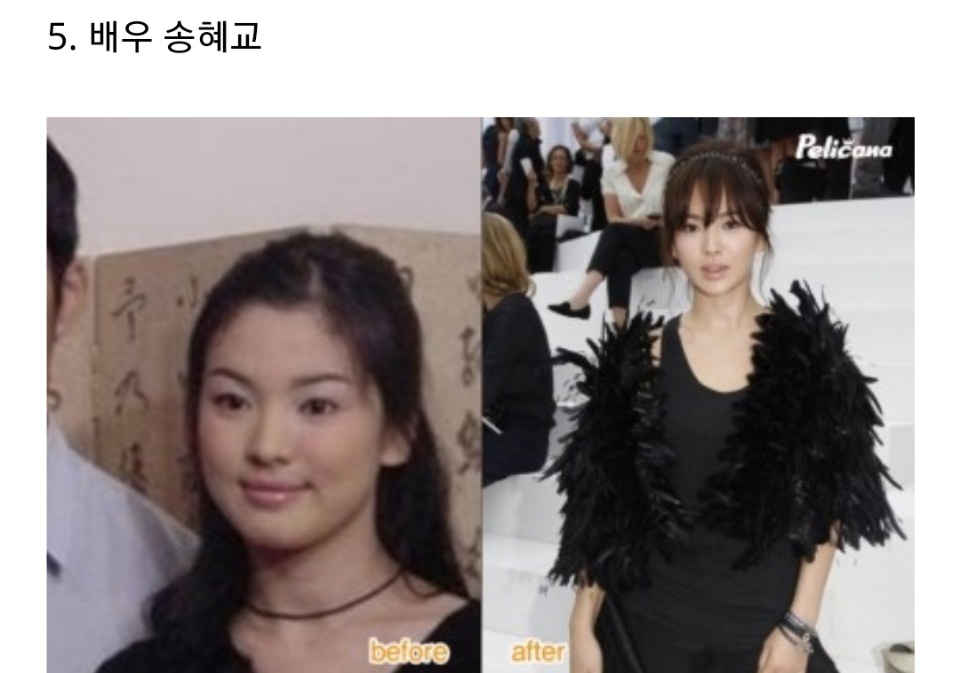 비포가아닌 에프터가되자