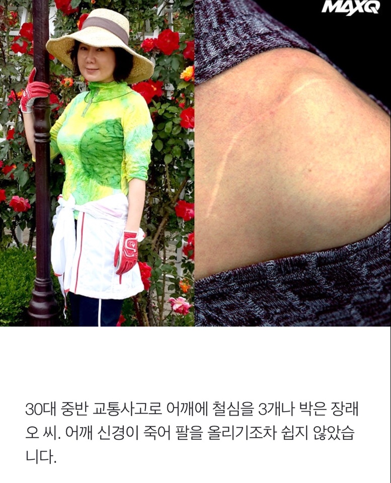 62세 믿겨지지 않는 몸매!