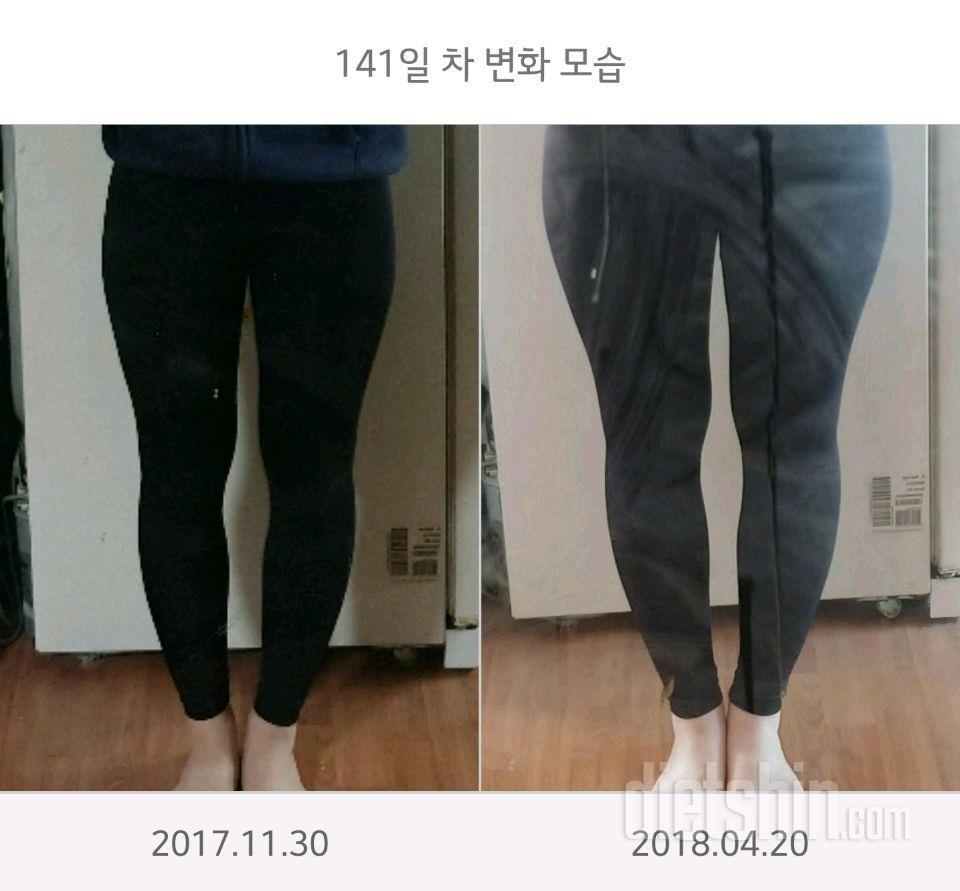 허벅지만 살이 찔수있는거죠.. ? 저주받은하체는 웁니ㅣㄷㆍ...