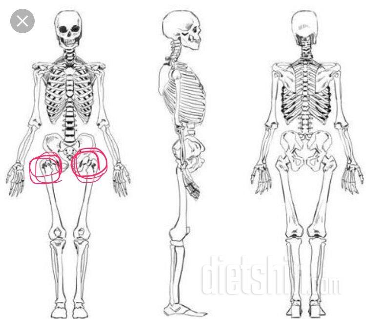 고관절쪽이 아파요ㅜ