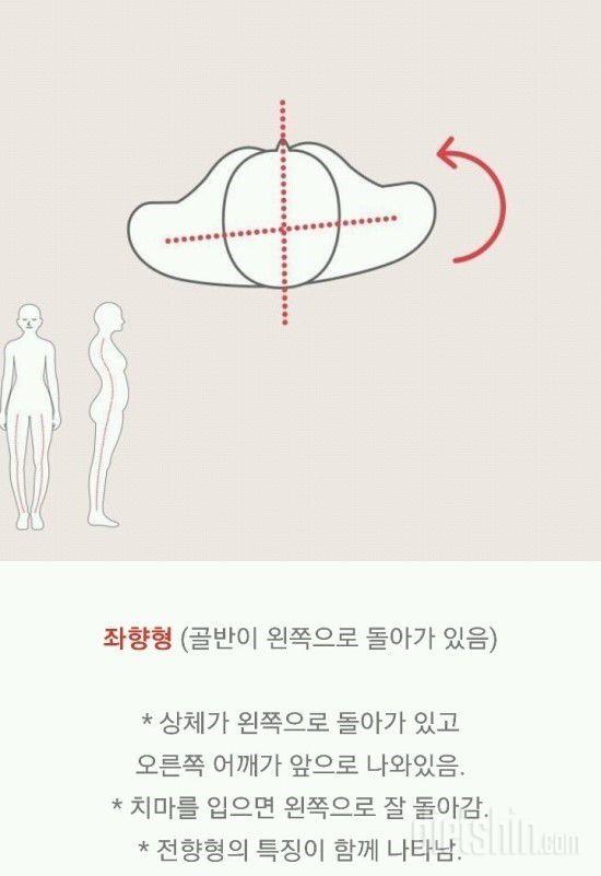 자기체형 테스트<골반 틀어짐 자가진단>