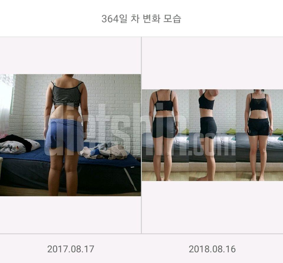 출산후 1년