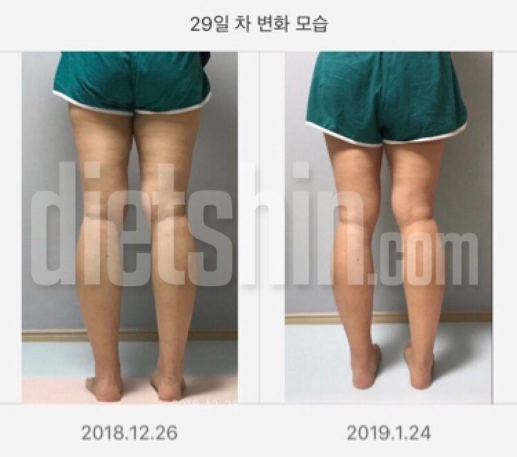 30일 다리라인 만들기 최종 후기