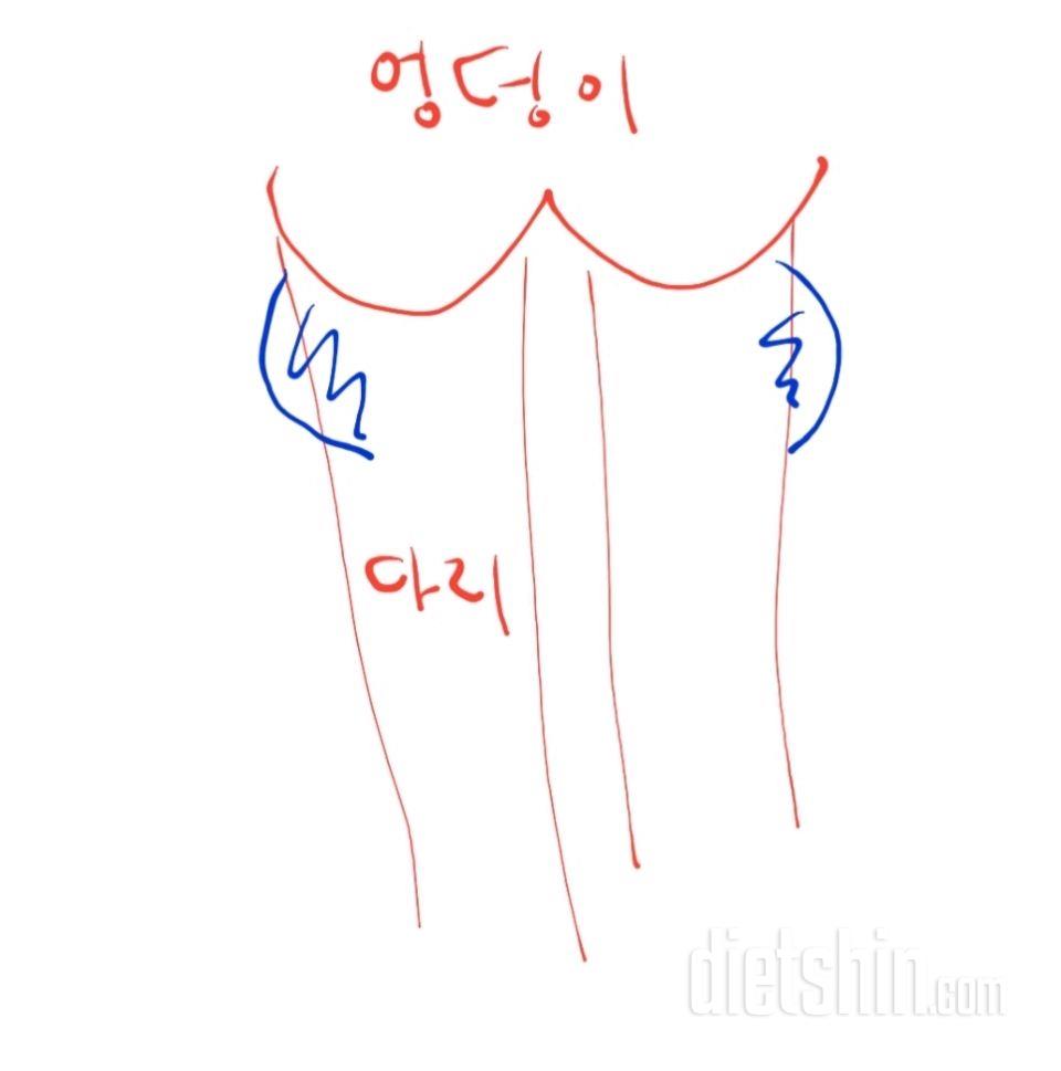 허벅지 뒤 엉덩이 아래가 뽈록 튀어나온건 어떻게 하죠..?