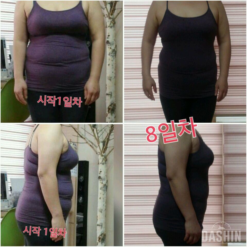 날뚱_8일차 비교사진입니다