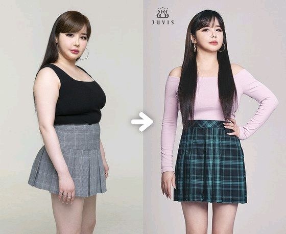 11kg감량한 박봄(오늘 기사)
