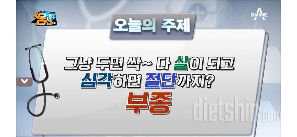 [하체부종 빼는 마사지법]-나는 몸신이다 210427