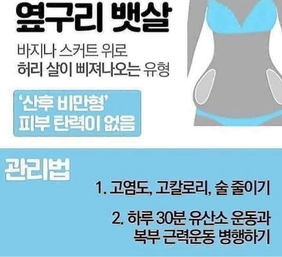 뱃살 유형