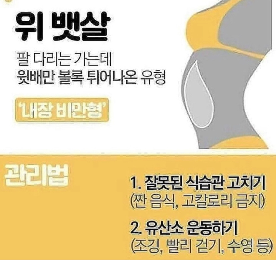 뱃살 유형