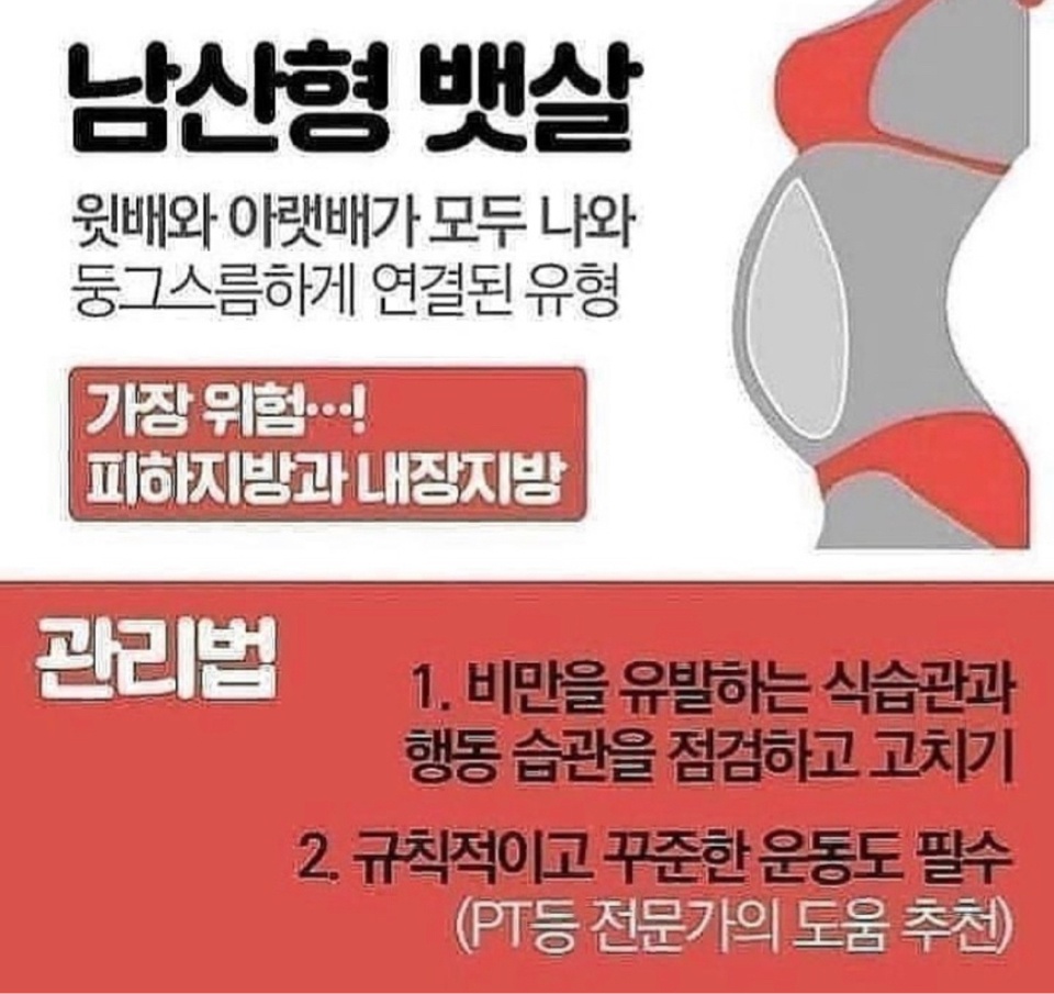 뱃살 유형