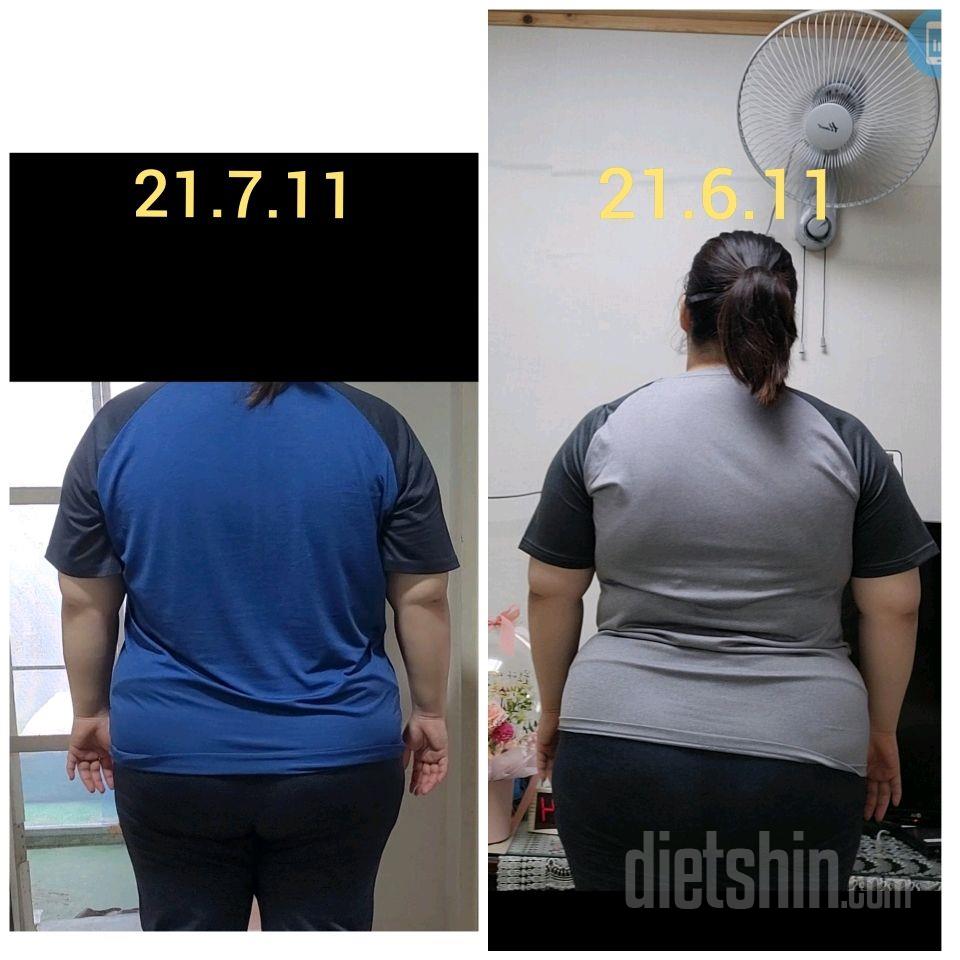 고도비만 1달 다이어트 비교사진