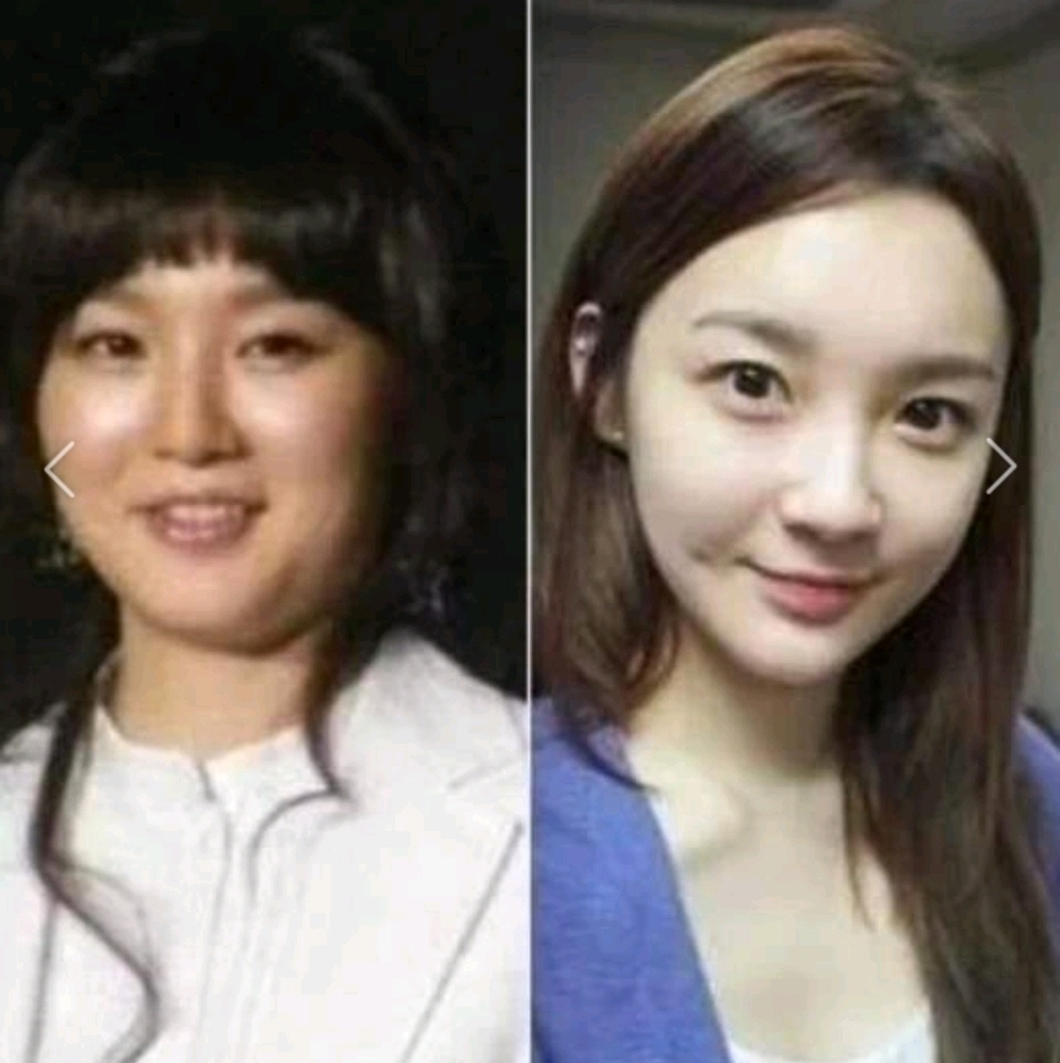 연예인 다이어트 전후