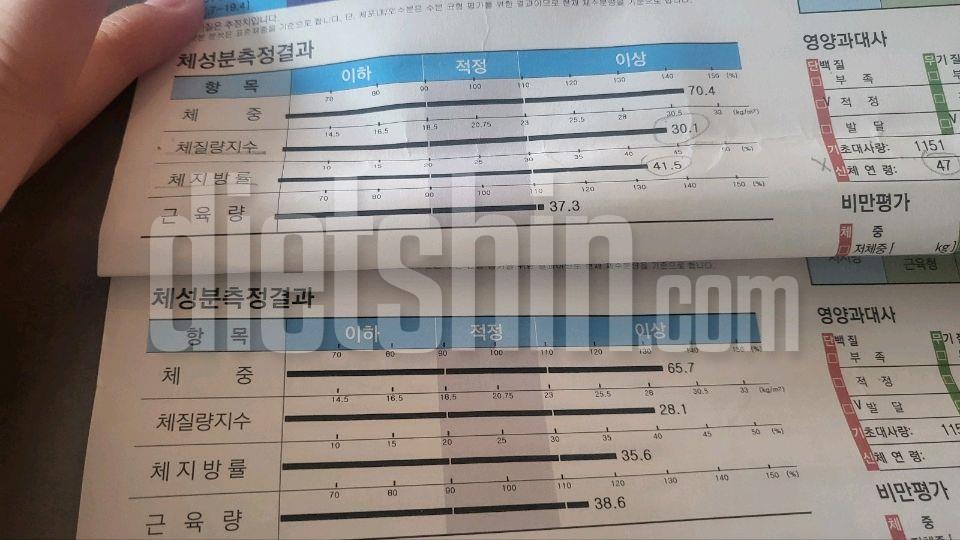 전 눈비디 변화는없지만  고도비만에서 비만이되었어요