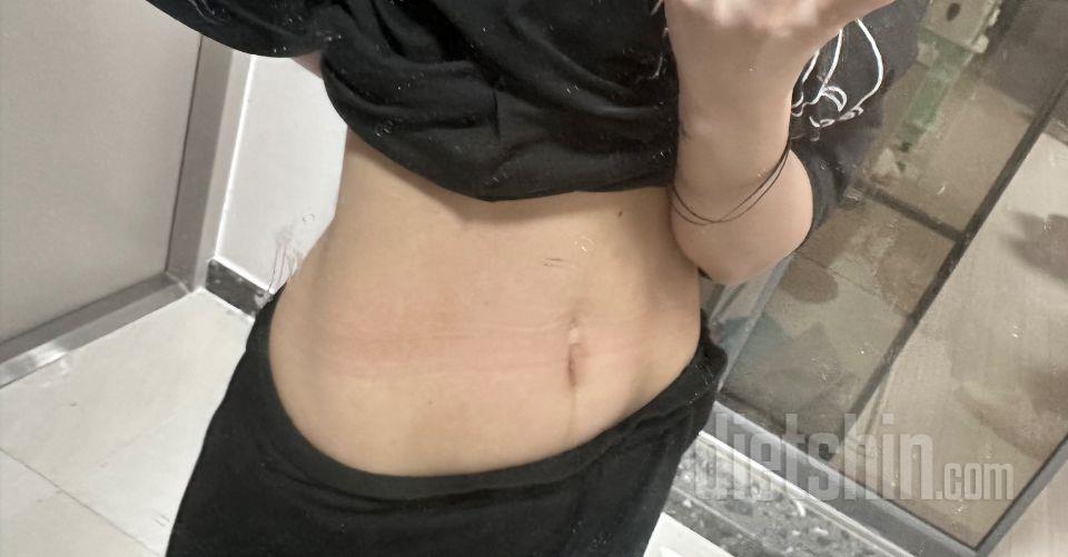 출산 후에 변비가 너무 심해져서 배가