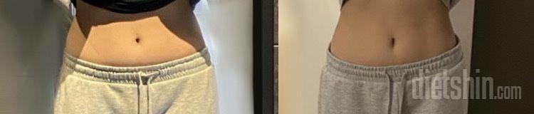 🍋 한 달 변화 | 위고비 없는 식욕억제법 / 스위치온후기