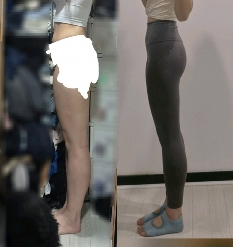 앞벅지가 빠지는부위인 하네요