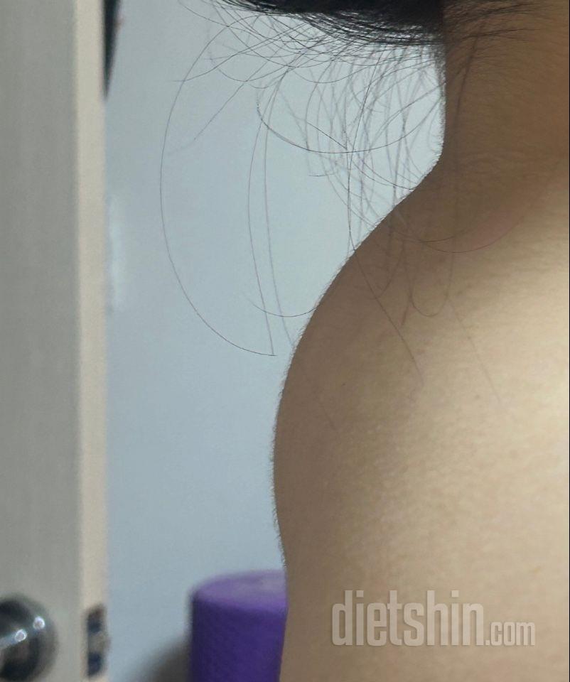 버섯목에 있는 지방