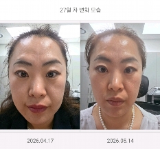 한달 비교