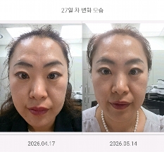 피부톤 비교
