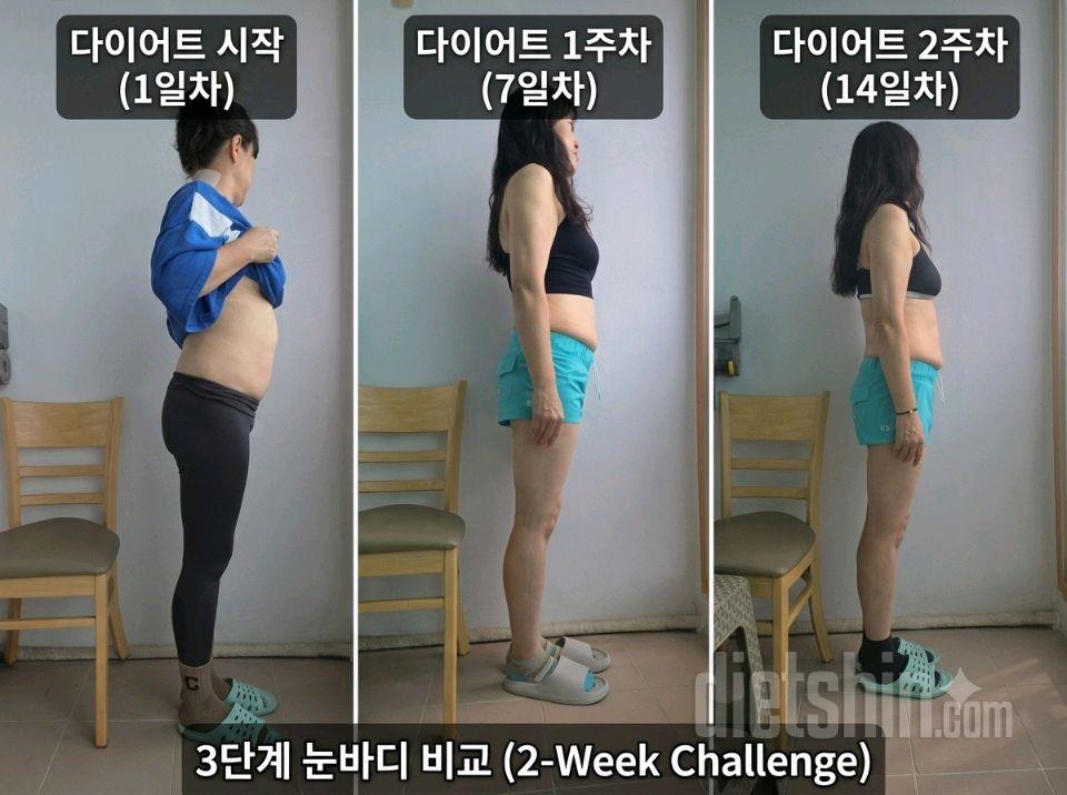 마운자로 2.5처방 2주차 (오늘 3번째 주사)온
