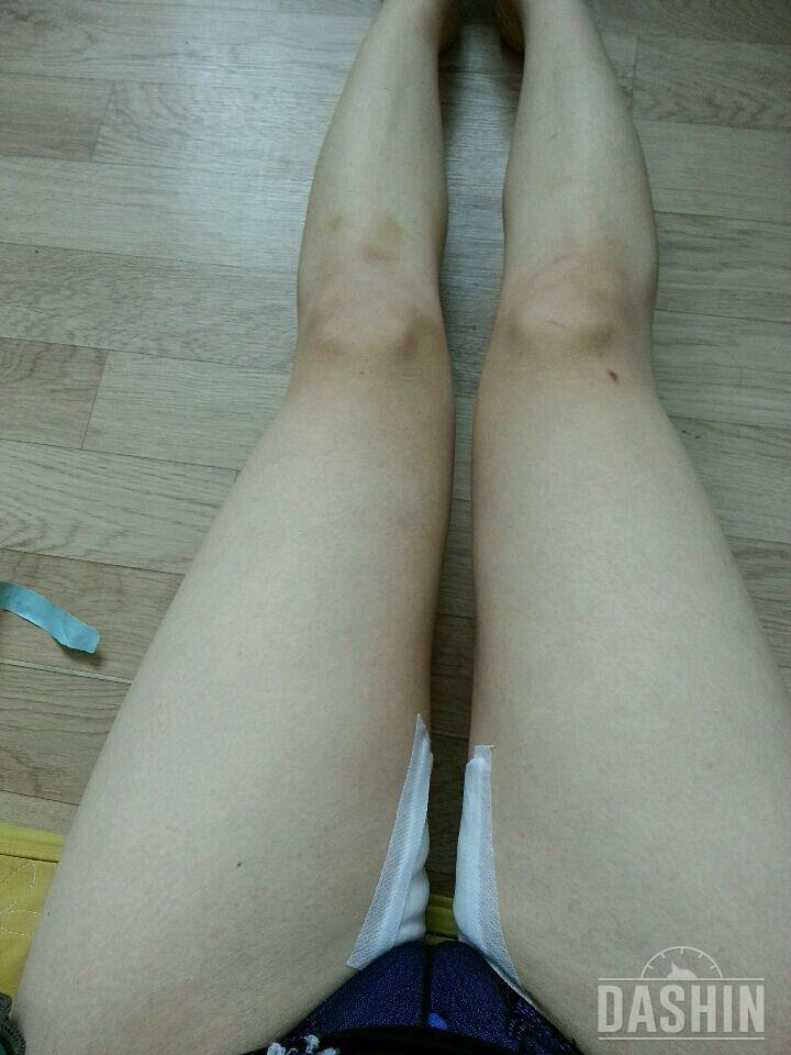 퐁당 헬프 바디패치 최종후기😎