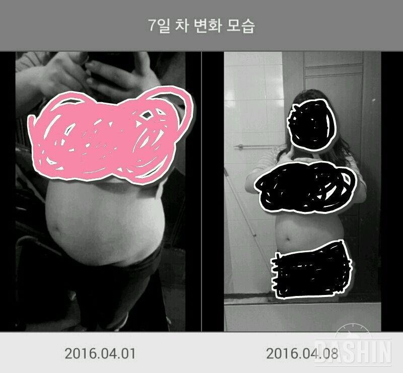 고도비만의 쉬운 다이어트 7일차