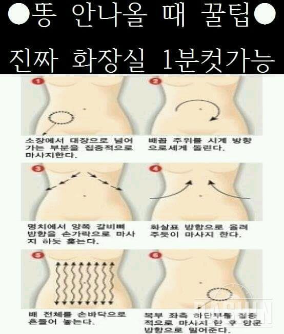 배변이 어려울때