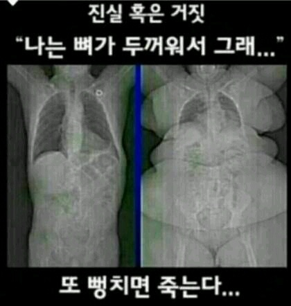 뼈