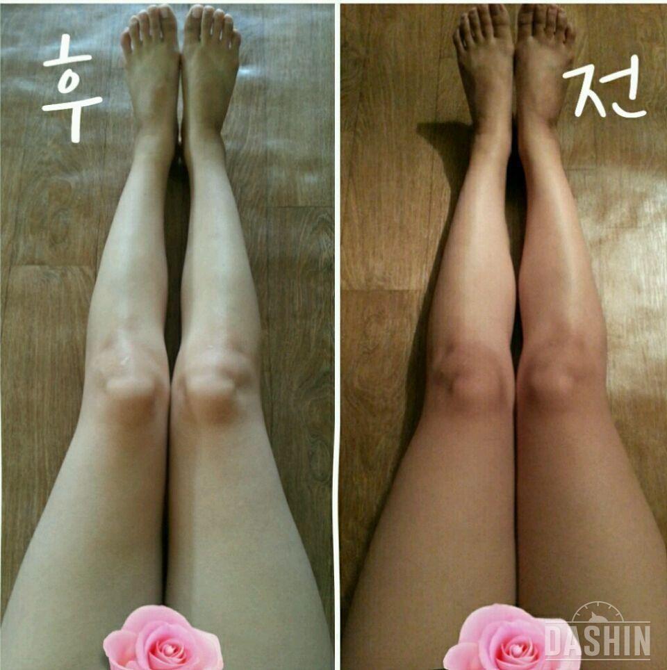 ☆다리라인 만들기 30일도전완료 후기☆