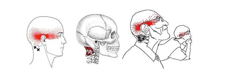 두통, 목 통증을 없애는 셀프 마사지 5가지!